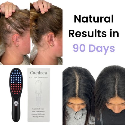 CaedreaBrush™ – Brosse 4-en-1 pour la pousse naturelle des cheveux