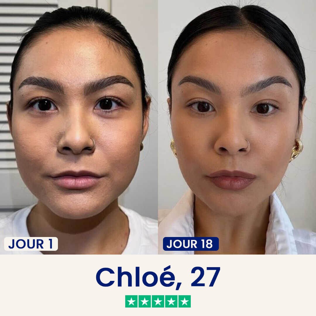 Le Chinology™ Lift (v2)