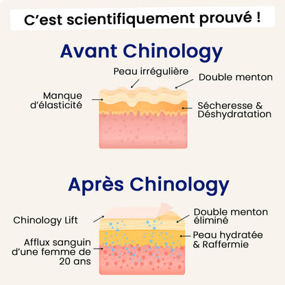 Le Chinology™ Lift (v2)